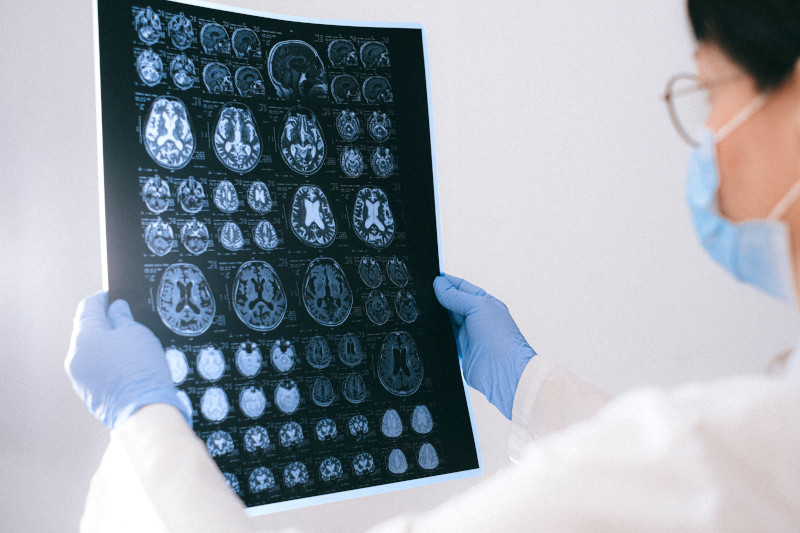 Use of Diagnostic Code 850 for Concussions